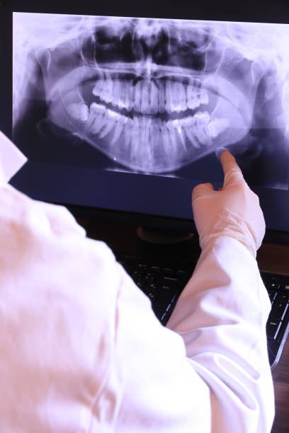Best Emergency Treatment for Dental Infections or Abscesses in Richland, GA