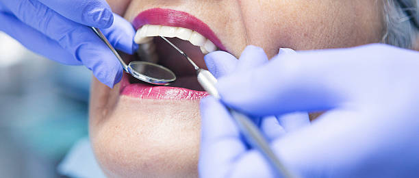 Best Emergency Tooth Extraction in Richland, GA